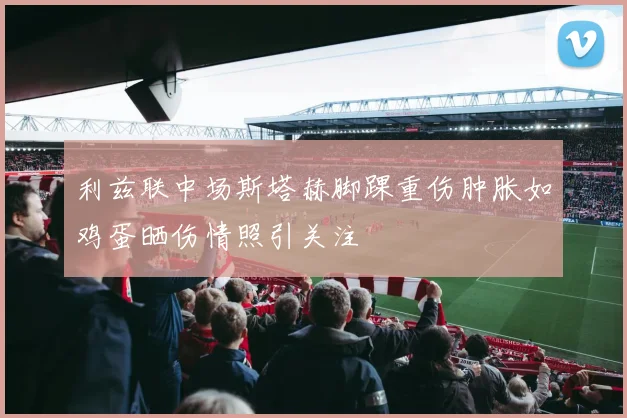 利兹联中场斯塔赫脚踝重伤肿胀如鸡蛋晒伤情照引关注